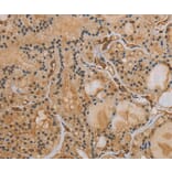 Immunohistochemistry - IPO9 Antibody from Signalway Antibody (37657) - Antibodies.com