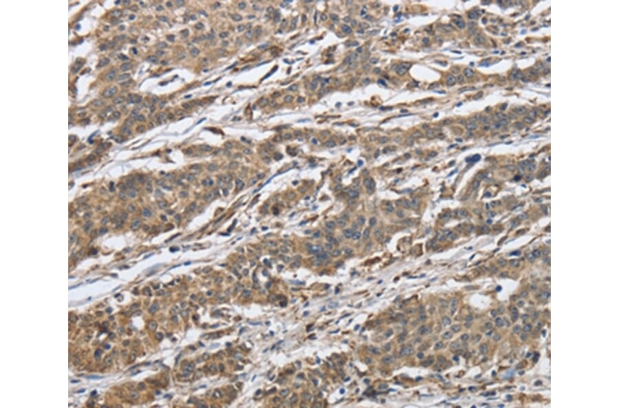 Immunohistochemistry - IPO7 Antibody from Signalway Antibody (37658) - Antibodies.com