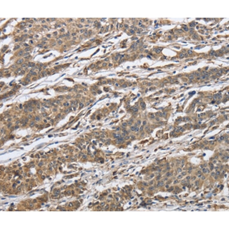 Immunohistochemistry - IPO7 Antibody from Signalway Antibody (37658) - Antibodies.com