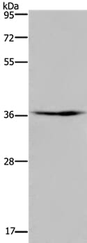 Gel: 8% SDS-PAGE Lysates (from left to right): Mouse skeletal muscle tissue Amount of lysate: 40ug per lane Primary antibody: 1/250 dilution Secondary antibody dilution: 1/8000 Exposure time: 5 minutes