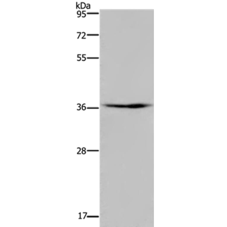 PIM3 Antibody from Signalway Antibody (37701) - Antibodies.com