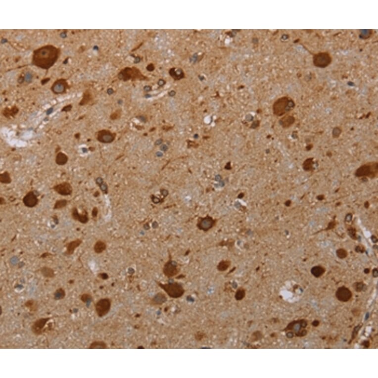 Immunohistochemistry - PIM3 Antibody from Signalway Antibody (37701) - Antibodies.com