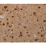 Immunohistochemistry - PIM3 Antibody from Signalway Antibody (37701) - Antibodies.com