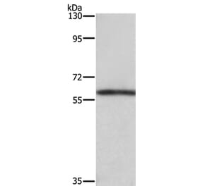 TBX5 Antibody from Signalway Antibody (37725) - Antibodies.com