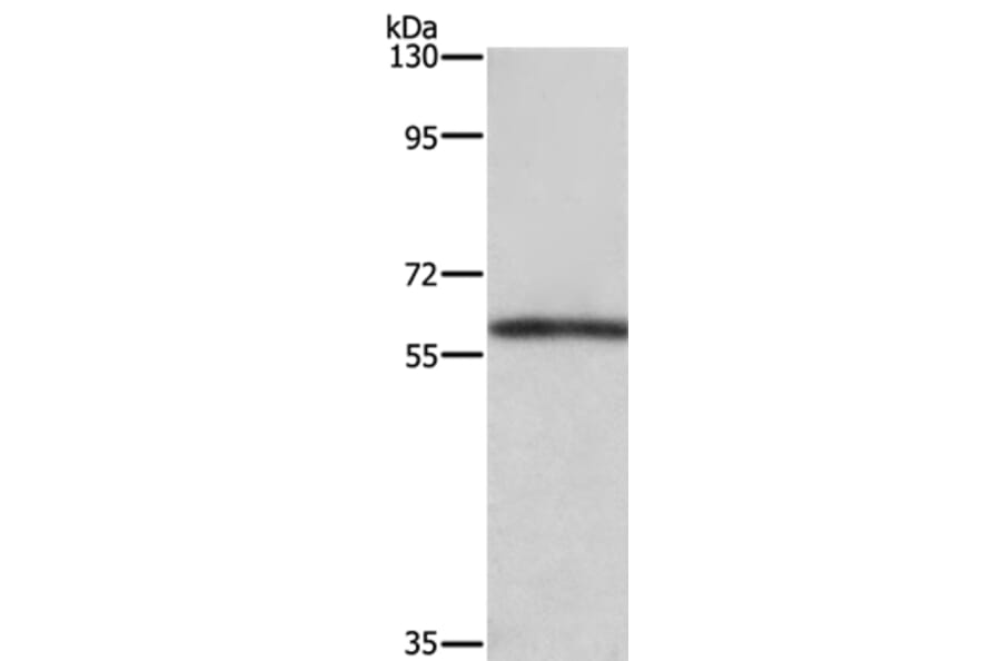 TBX5 Antibody from Signalway Antibody (37725) - Antibodies.com