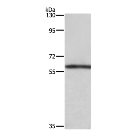 TBX5 Antibody from Signalway Antibody (37725) - Antibodies.com