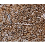 Immunohistochemistry - TBX5 Antibody from Signalway Antibody (37725) - Antibodies.com