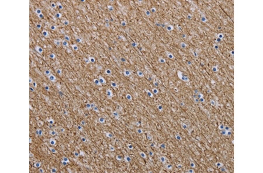 Immunohistochemistry - NEFM Antibody from Signalway Antibody (37760) - Antibodies.com