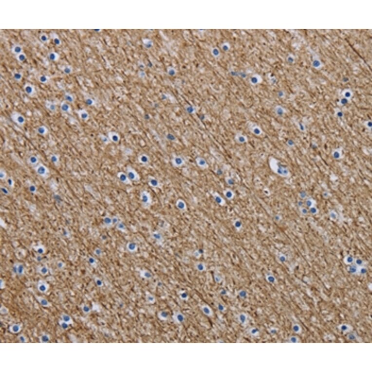 Immunohistochemistry - NEFM Antibody from Signalway Antibody (37760) - Antibodies.com