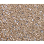 Immunohistochemistry - NEFM Antibody from Signalway Antibody (37760) - Antibodies.com