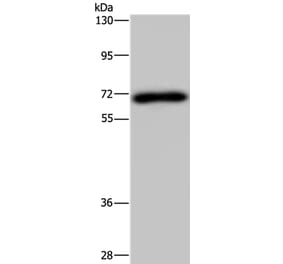 NMT1 Antibody from Signalway Antibody (37769) - Antibodies.com
