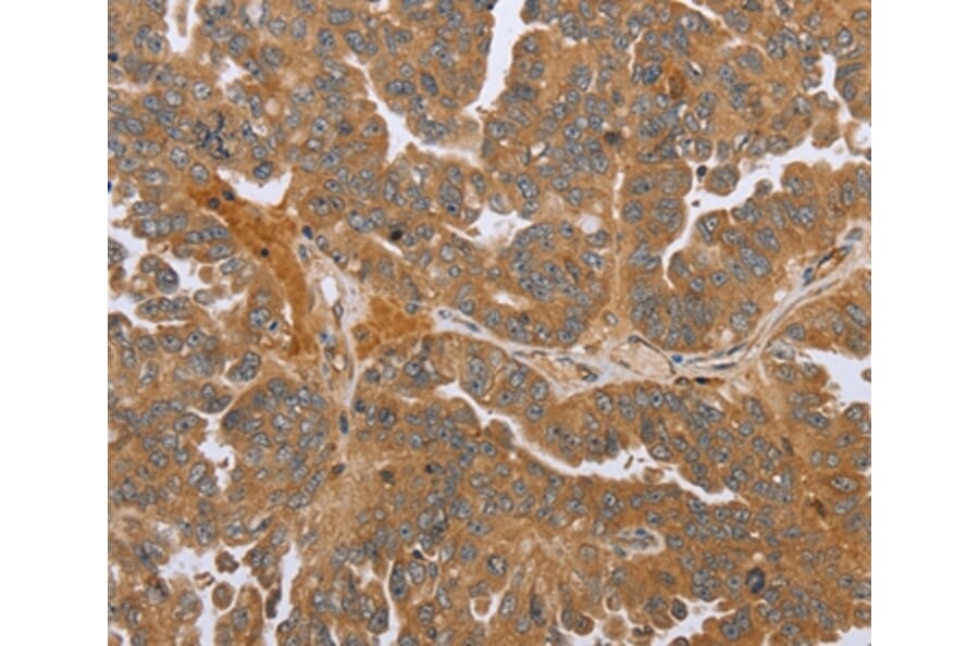 Immunohistochemistry - NMT1 Antibody from Signalway Antibody (37769) - Antibodies.com