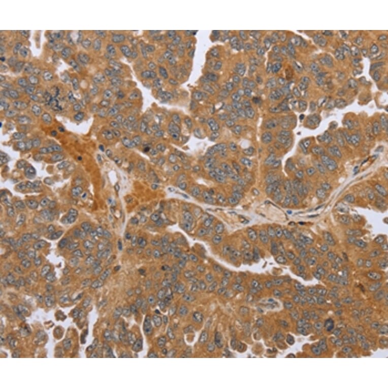 Immunohistochemistry - NMT1 Antibody from Signalway Antibody (37769) - Antibodies.com