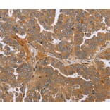 Immunohistochemistry - NMT1 Antibody from Signalway Antibody (37769) - Antibodies.com