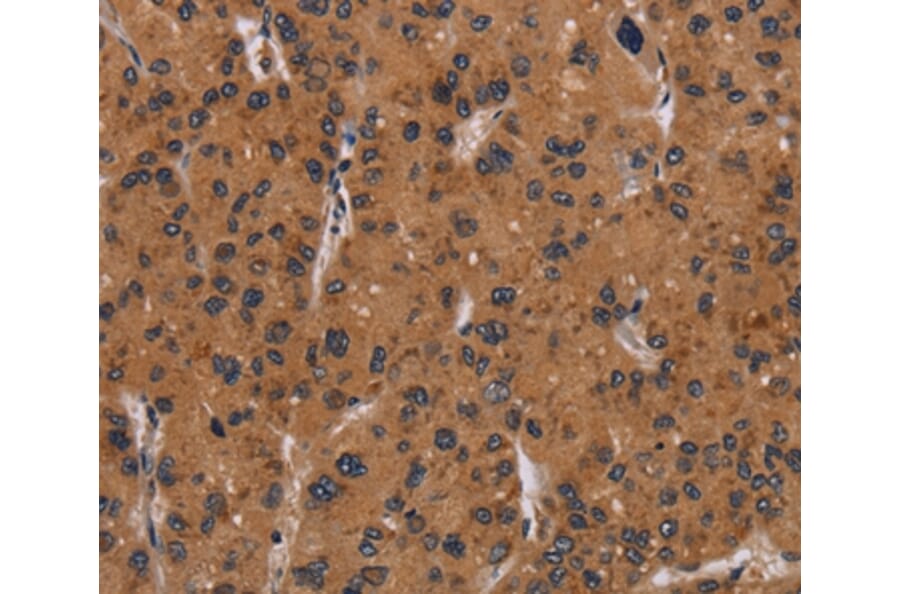 Immunohistochemistry - NRAS Antibody from Signalway Antibody (37777) - Antibodies.com