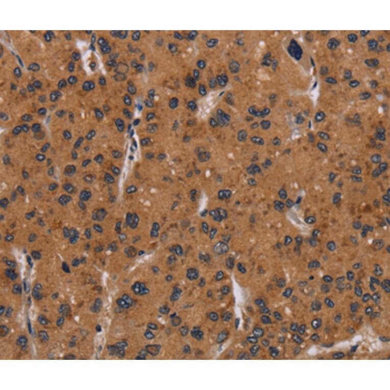 Immunohistochemistry - NRAS Antibody from Signalway Antibody (37777) - Antibodies.com