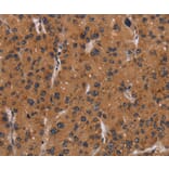 Immunohistochemistry - NRAS Antibody from Signalway Antibody (37777) - Antibodies.com
