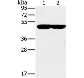 PPOX Antibody from Signalway Antibody (37844) - Antibodies.com