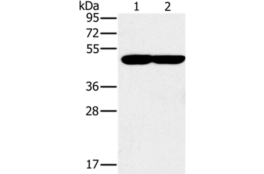 PPOX Antibody from Signalway Antibody (37844) - Antibodies.com