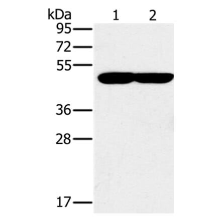 PPOX Antibody from Signalway Antibody (37844) - Antibodies.com