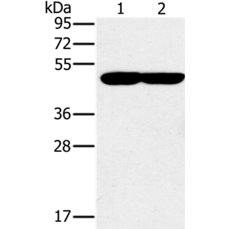 PPOX Antibody from Signalway Antibody (37844) - Antibodies.com