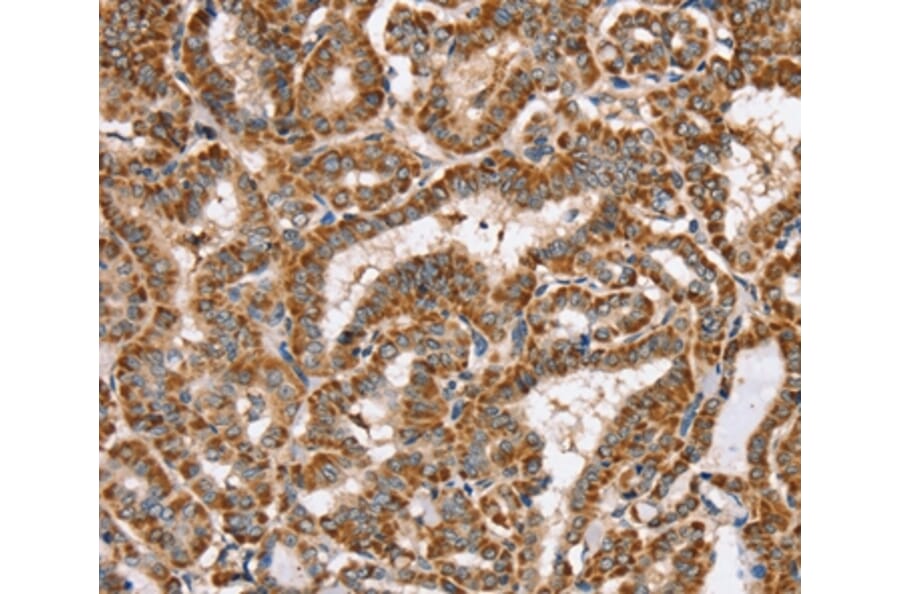 Immunohistochemistry - PPOX Antibody from Signalway Antibody (37844) - Antibodies.com
