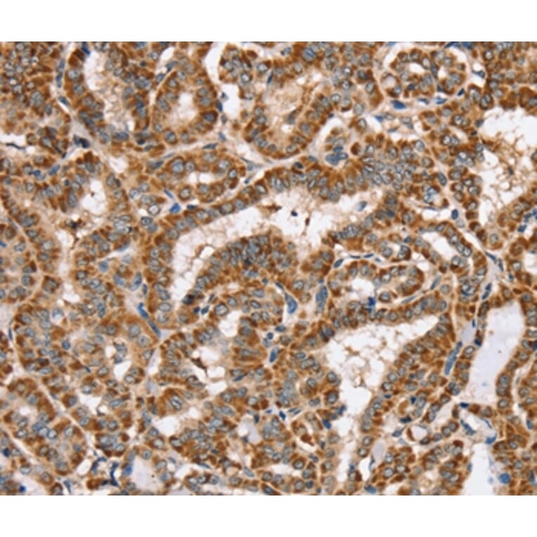 Immunohistochemistry - PPOX Antibody from Signalway Antibody (37844) - Antibodies.com