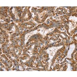 Immunohistochemistry - PPOX Antibody from Signalway Antibody (37844) - Antibodies.com