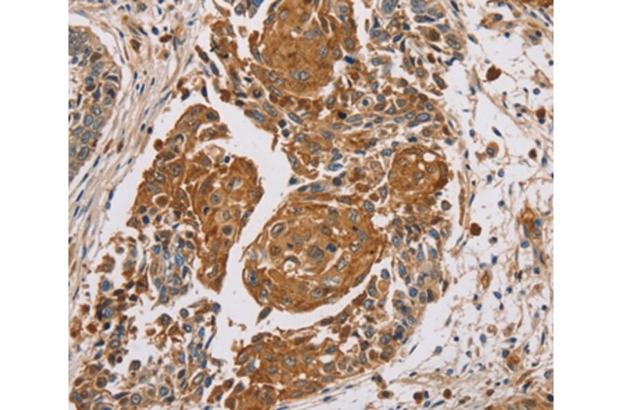 Immunohistochemistry - MUC1 Antibody from Signalway Antibody (37857) - Antibodies.com