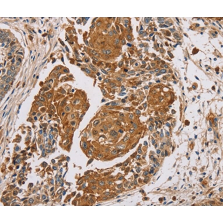 Immunohistochemistry - MUC1 Antibody from Signalway Antibody (37857) - Antibodies.com