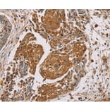 Immunohistochemistry - MUC1 Antibody from Signalway Antibody (37857) - Antibodies.com