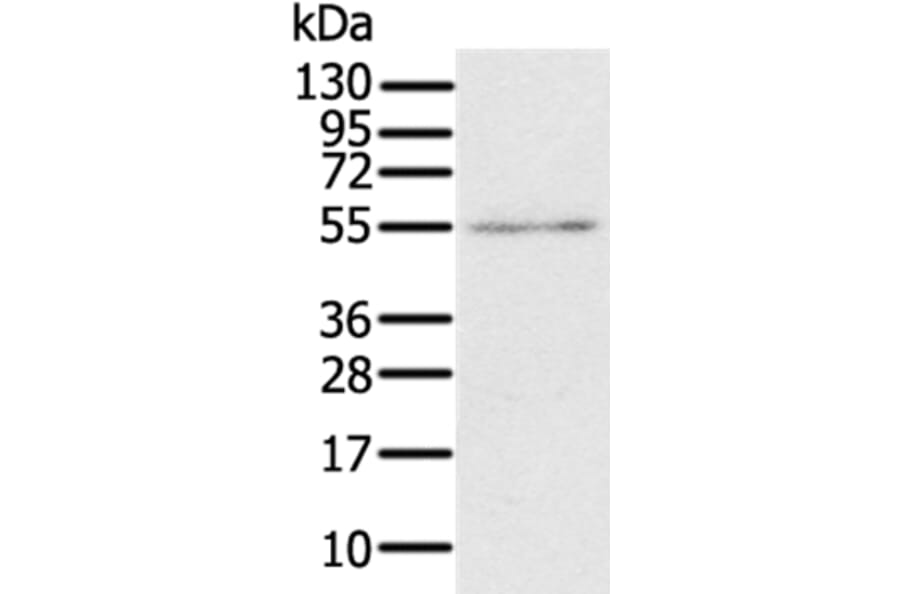 RORB Antibody from Signalway Antibody (37880) - Antibodies.com