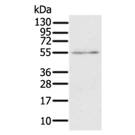 RORB Antibody from Signalway Antibody (37880) - Antibodies.com