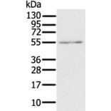 RORB Antibody from Signalway Antibody (37880) - Antibodies.com