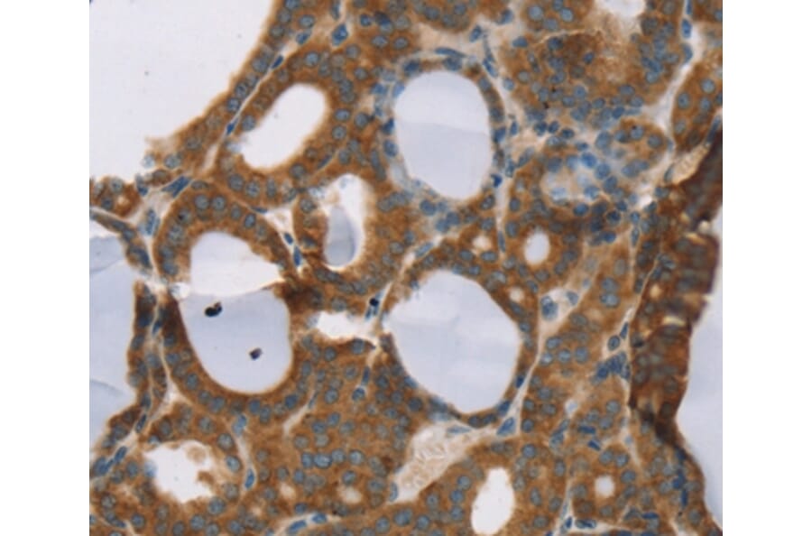 Immunohistochemistry - RORB Antibody from Signalway Antibody (37880) - Antibodies.com