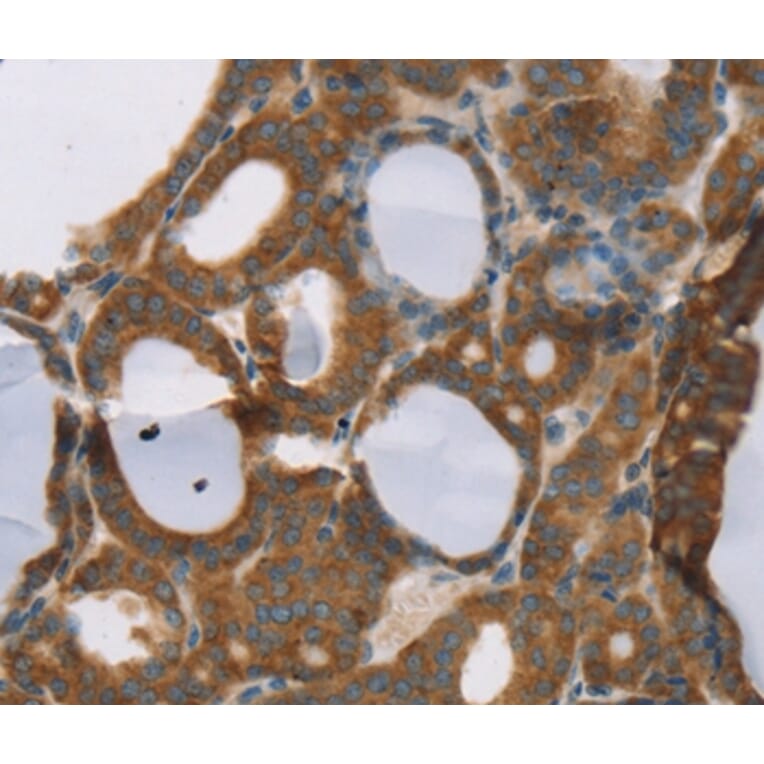 Immunohistochemistry - RORB Antibody from Signalway Antibody (37880) - Antibodies.com