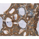 Immunohistochemistry - RORB Antibody from Signalway Antibody (37880) - Antibodies.com