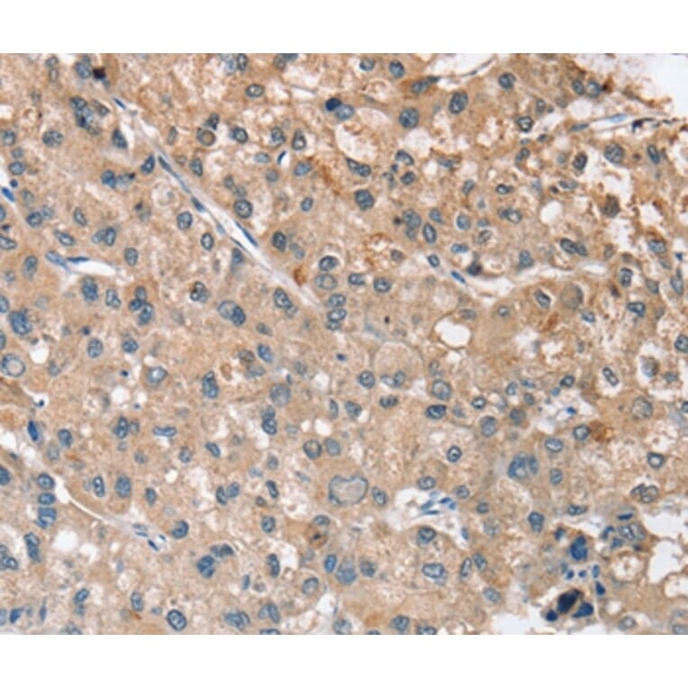 Immunohistochemistry - RRAS Antibody from Signalway Antibody (37881) - Antibodies.com