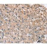 Immunohistochemistry - RRAS Antibody from Signalway Antibody (37881) - Antibodies.com