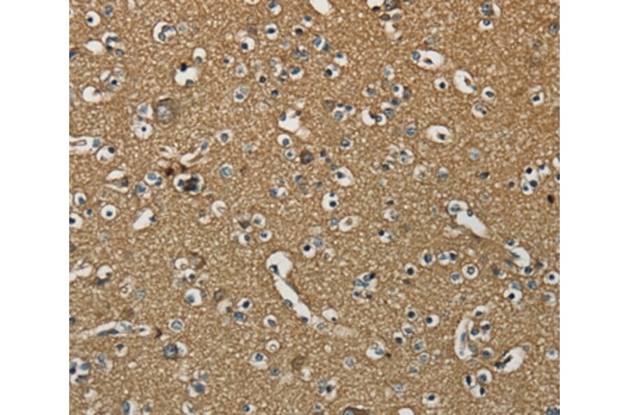 Immunohistochemistry - NEMF Antibody from Signalway Antibody (37902) - Antibodies.com
