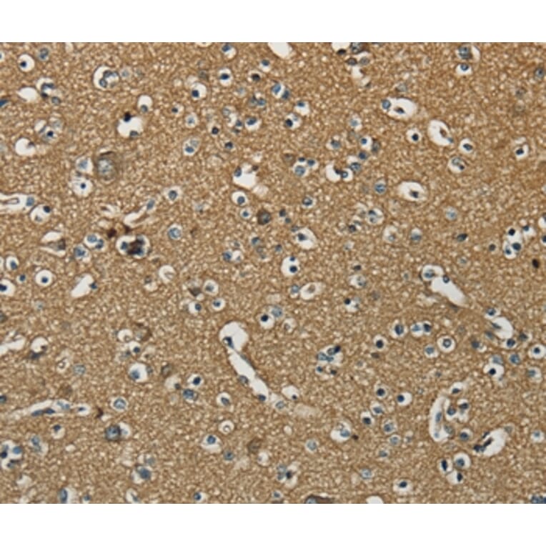Immunohistochemistry - NEMF Antibody from Signalway Antibody (37902) - Antibodies.com