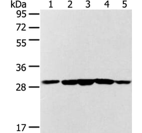 SDHB Antibody from Signalway Antibody (37903) - Antibodies.com