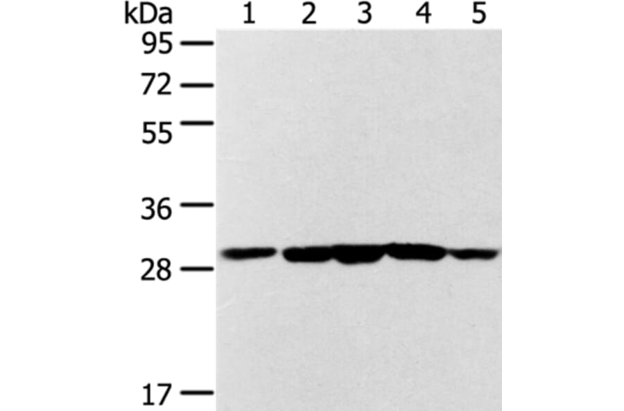 SDHB Antibody from Signalway Antibody (37903) - Antibodies.com