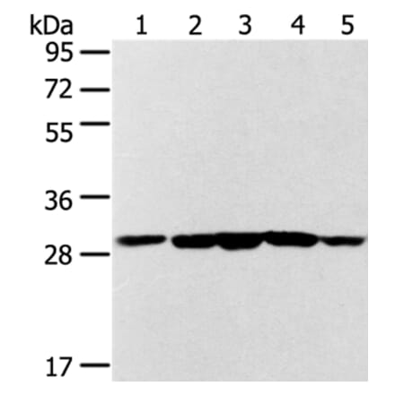 SDHB Antibody from Signalway Antibody (37903) - Antibodies.com
