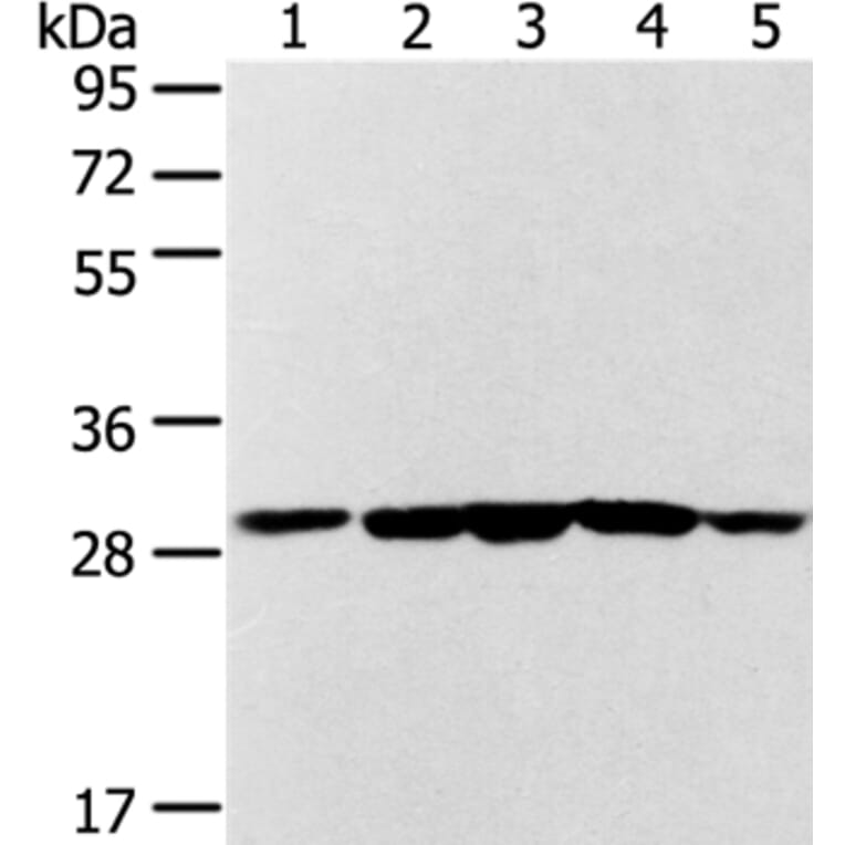 SDHB Antibody from Signalway Antibody (37903) - Antibodies.com