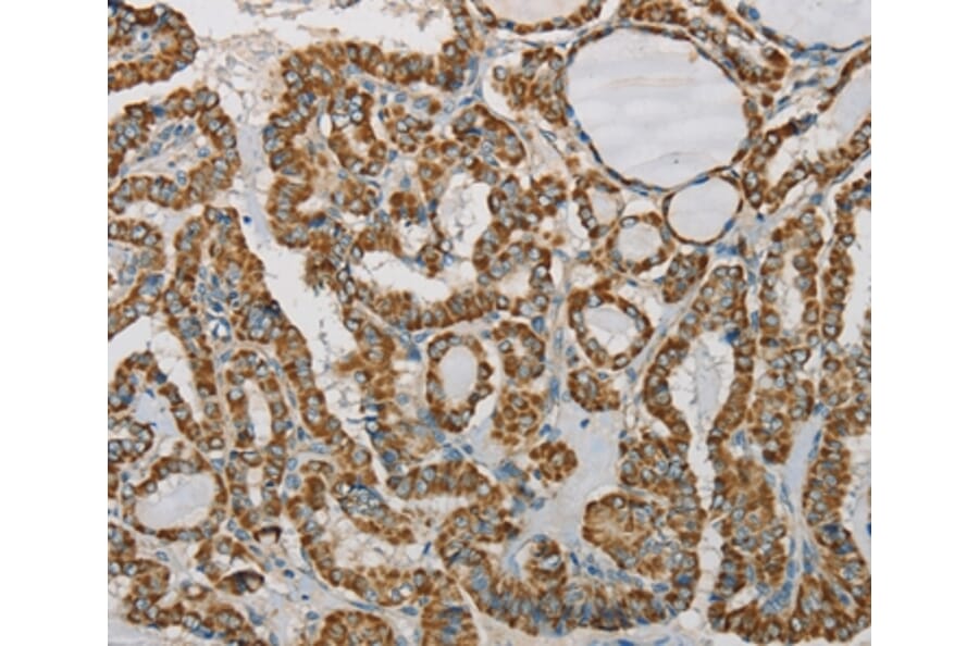 Immunohistochemistry - SDHB Antibody from Signalway Antibody (37903) - Antibodies.com