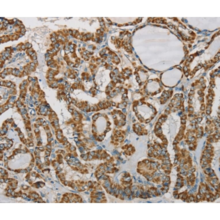 Immunohistochemistry - SDHB Antibody from Signalway Antibody (37903) - Antibodies.com