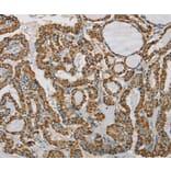 Immunohistochemistry - SDHB Antibody from Signalway Antibody (37903) - Antibodies.com