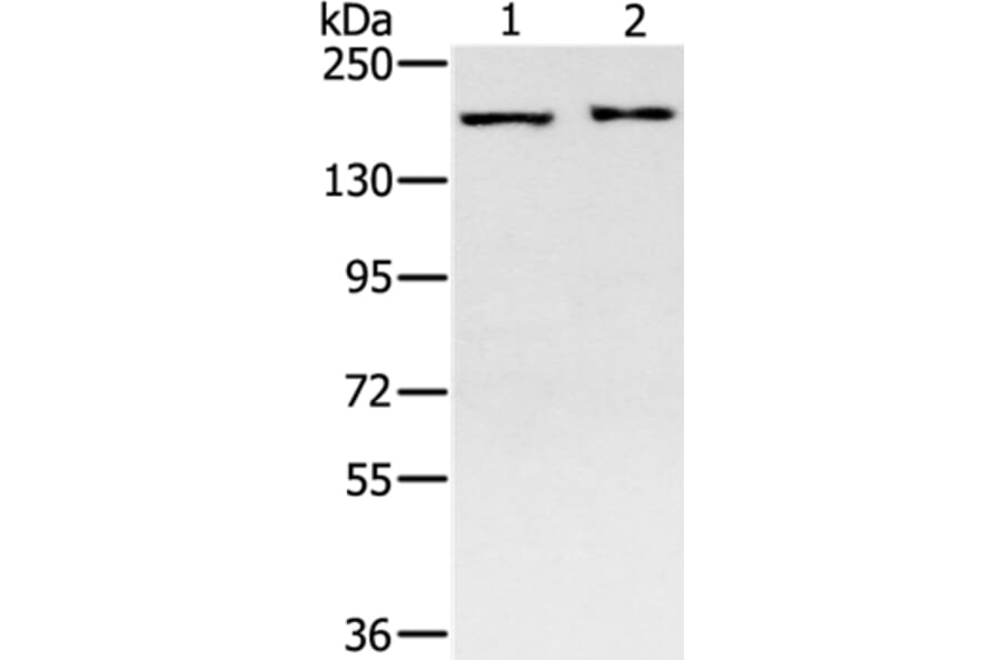 SMC4 Antibody from Signalway Antibody (37957) - Antibodies.com