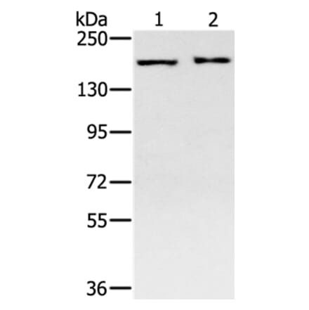 SMC4 Antibody from Signalway Antibody (37957) - Antibodies.com